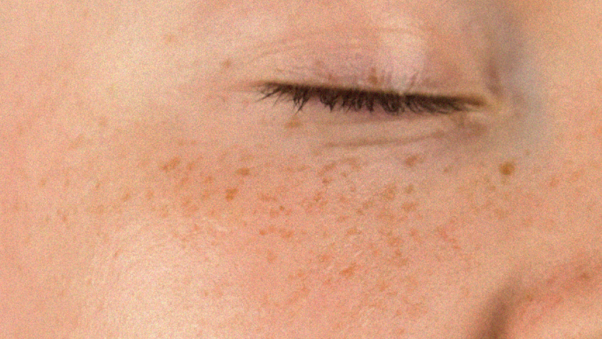 VITAMIN C 101: How To Use It & What Are The Benefits?