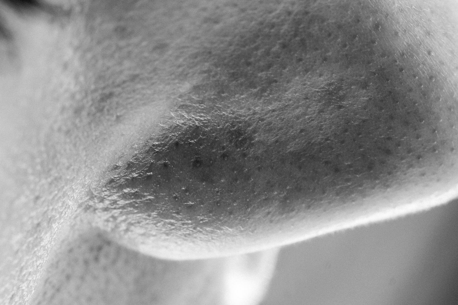 How To Tackle Big Pores