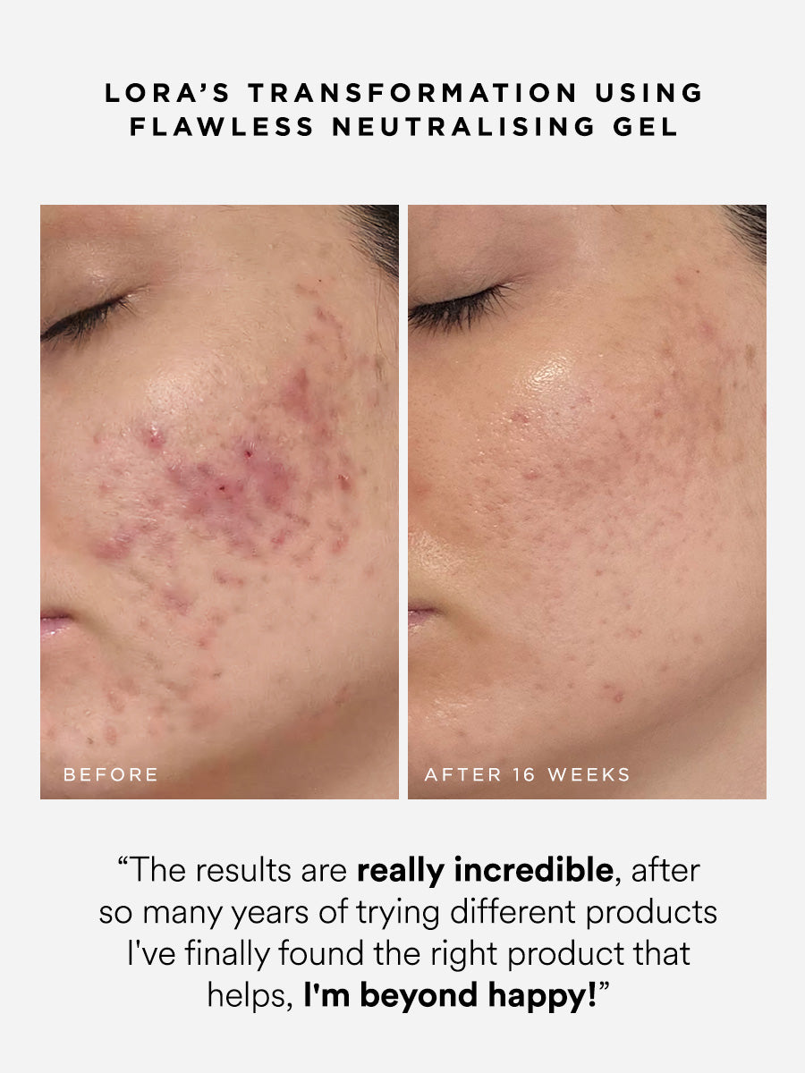 Flawless Neutralising Gel Roller