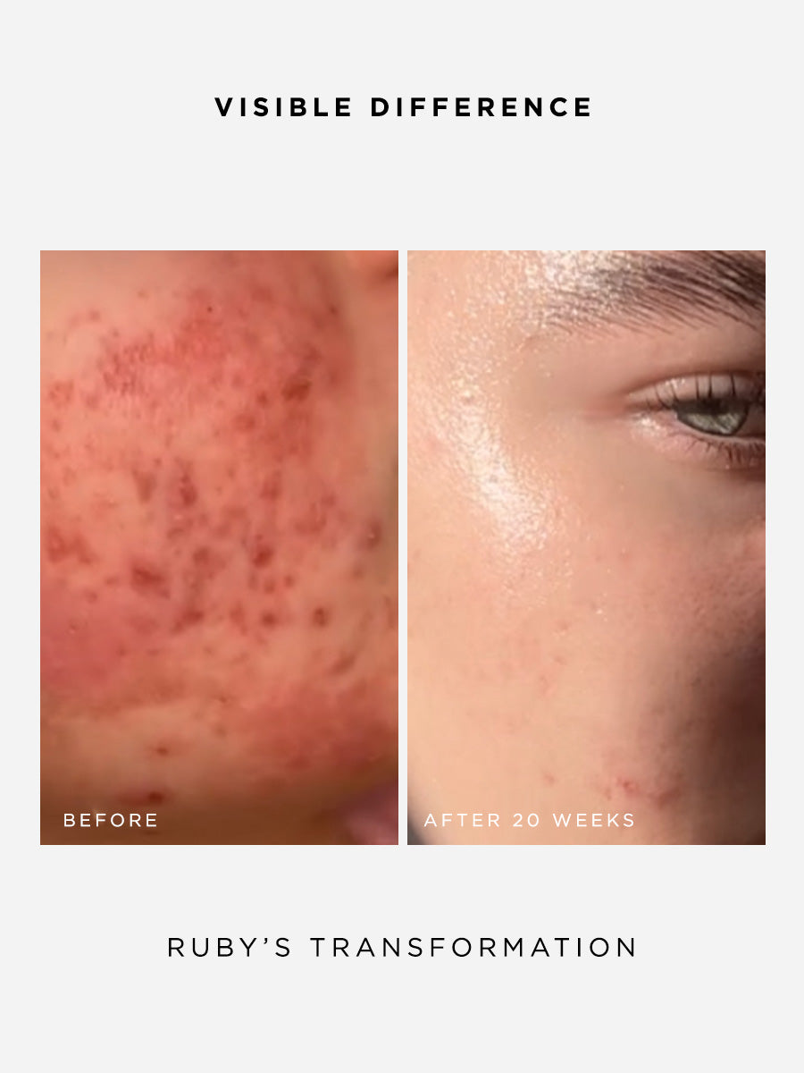 The Clarity Full Size Set