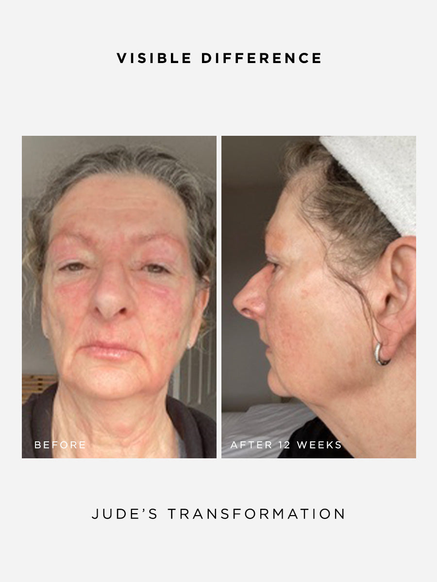 The Radiance Full Size Set