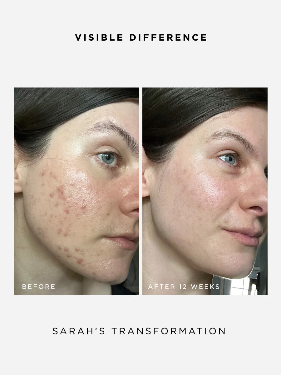 The Clarity Full Size Set