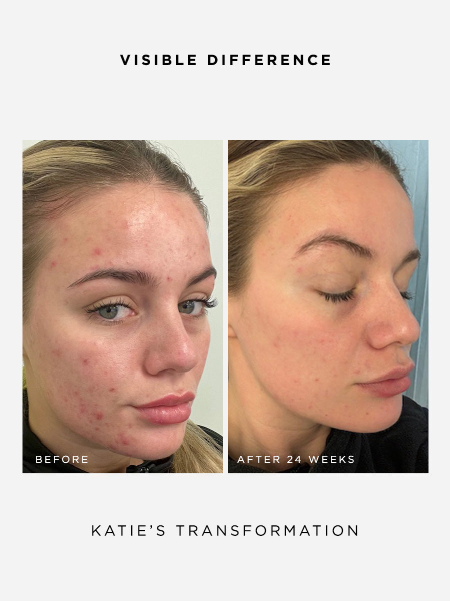 The Clarity Full Size Set