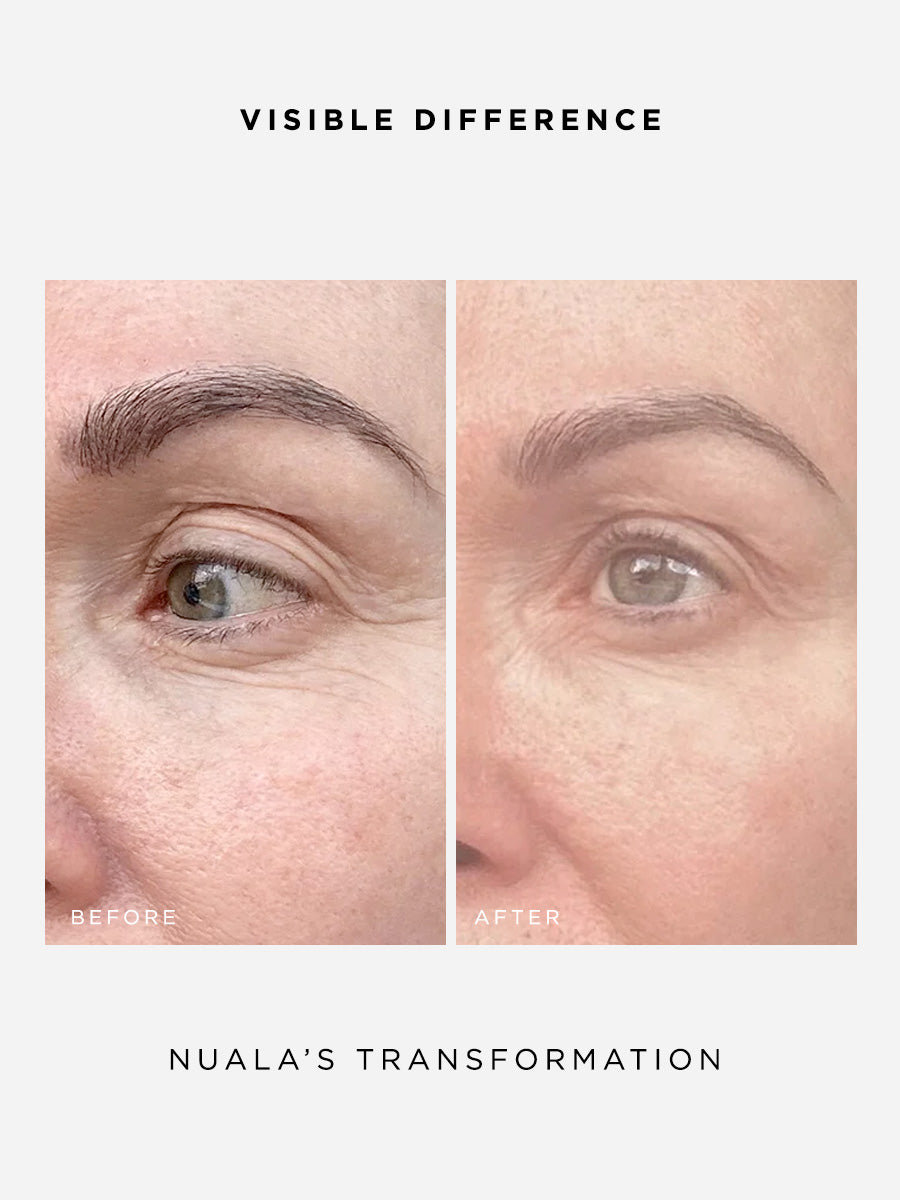 The Radiance Full Size Set