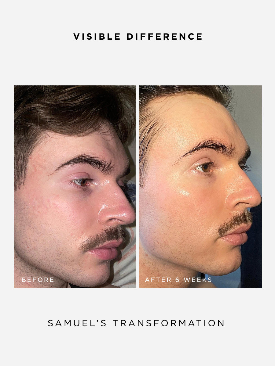 The Radiance Full Size Set