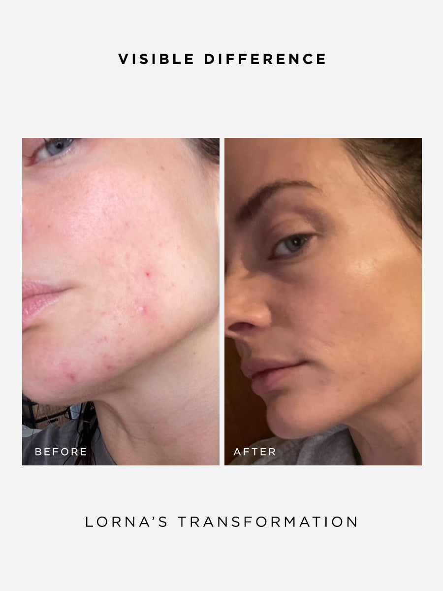 The Clarity Full Size Set