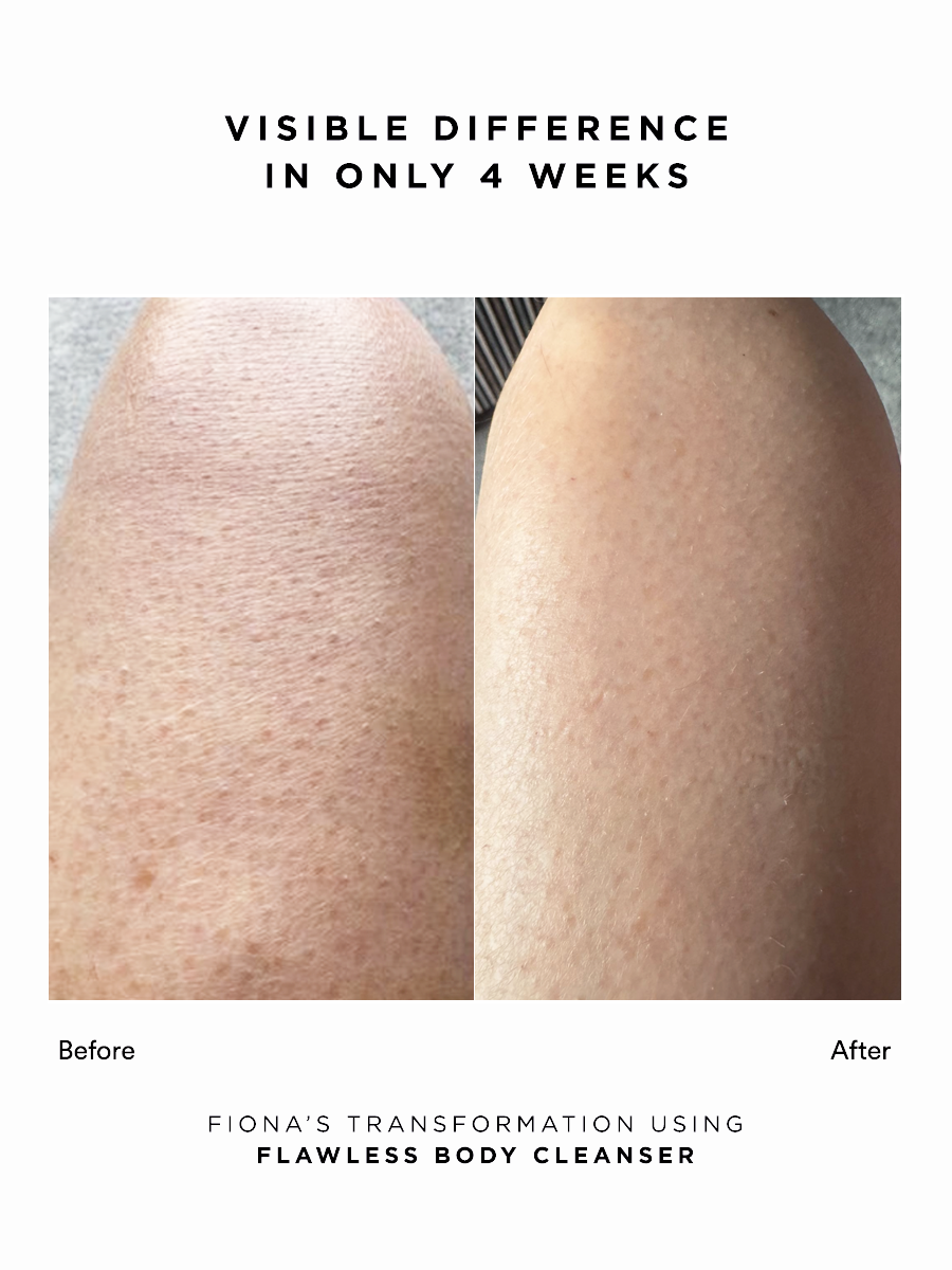 Flawless Body Cleanser