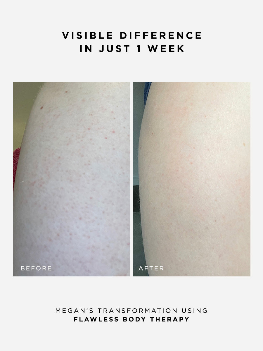 The Body Confidence Set