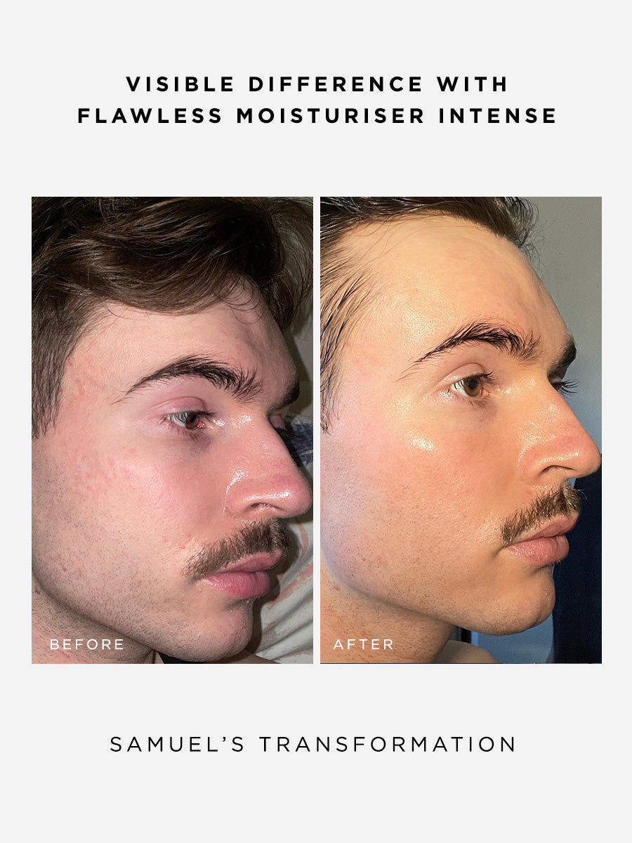 The Radiance Full Size Set