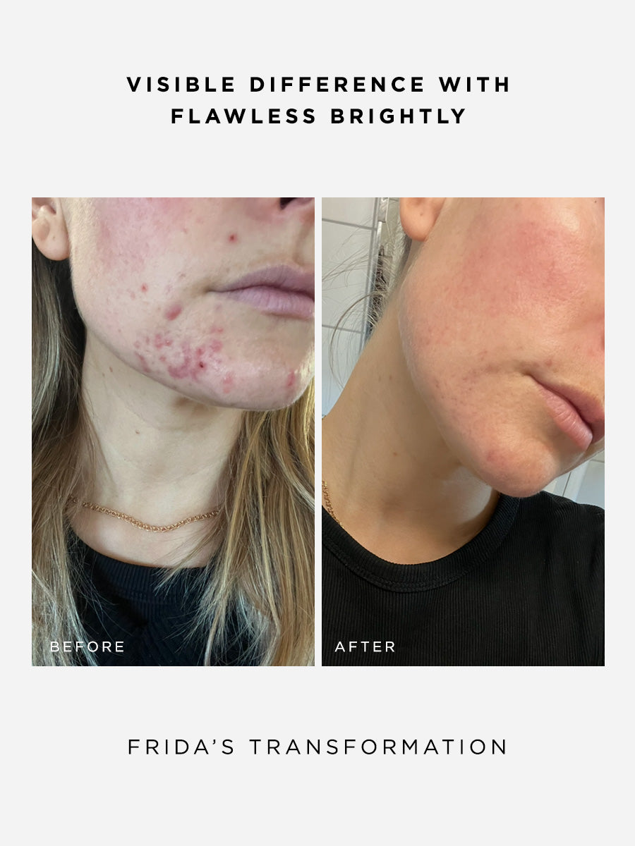 The Clarity Full Size Set