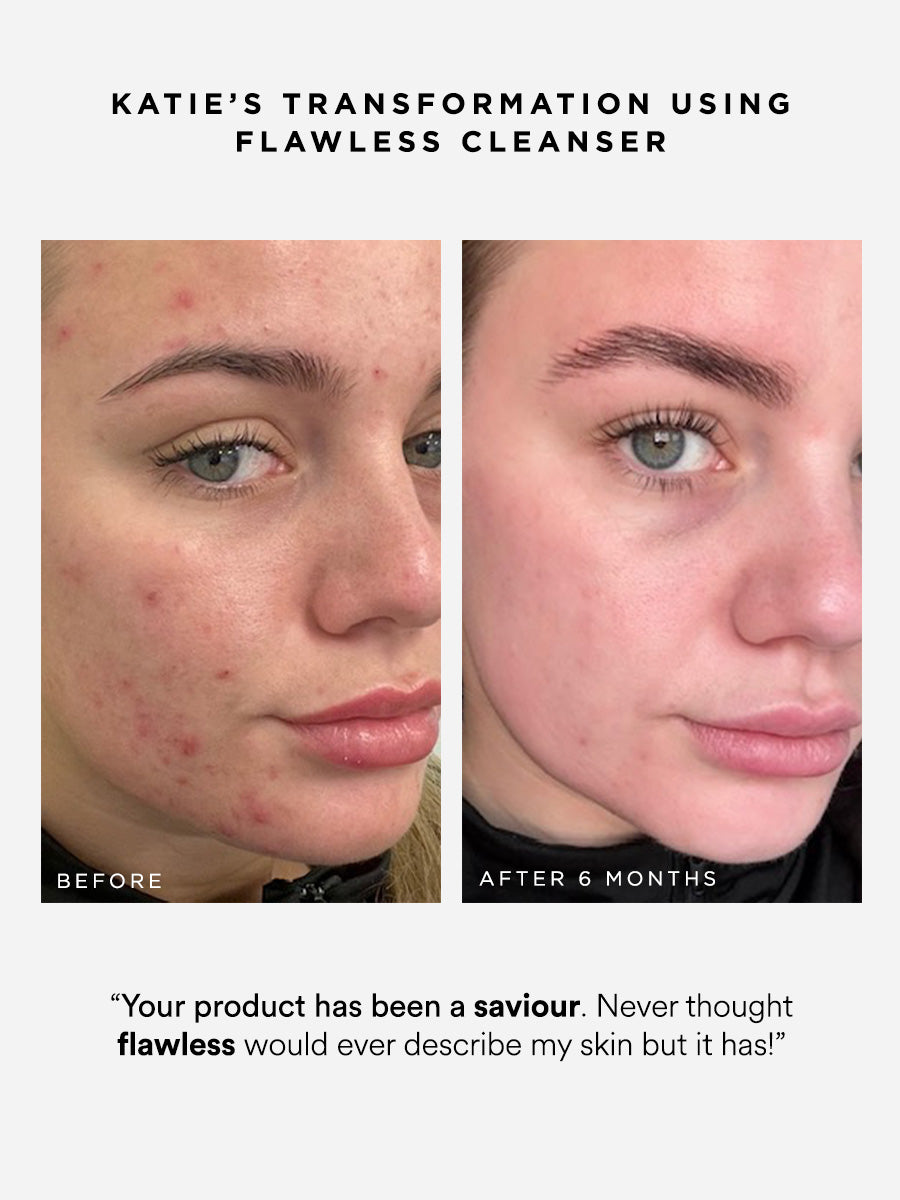 Flawless Cleanser