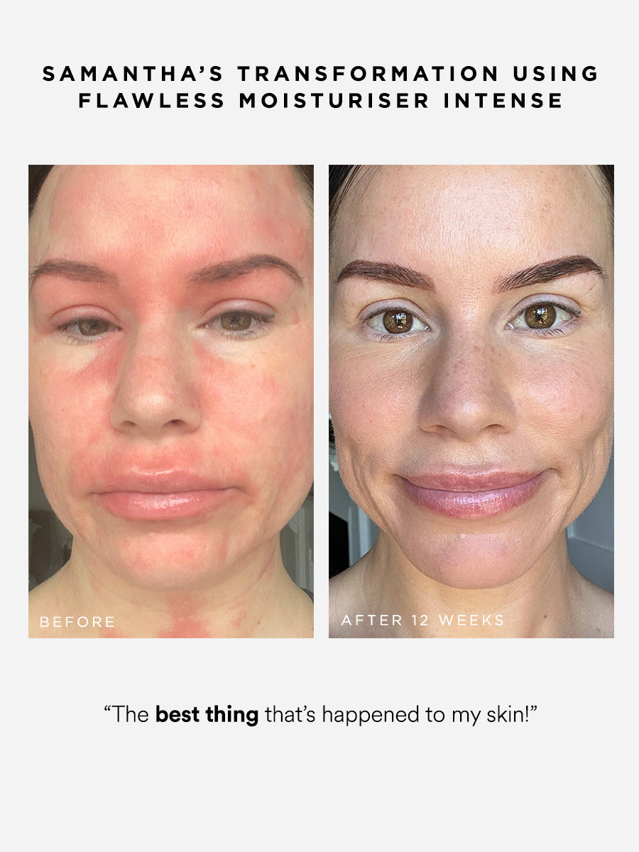 Flawless Moisturiser Intense