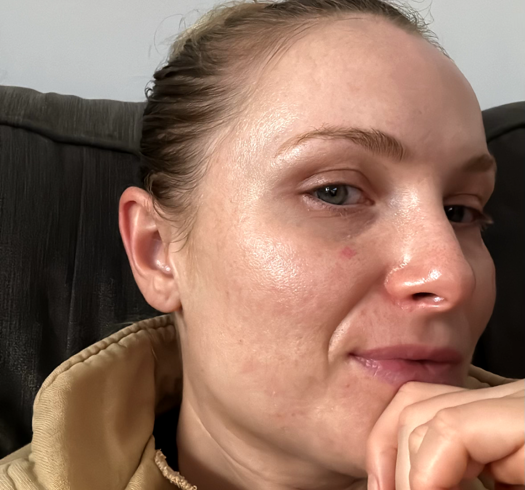 After image of MADELINE