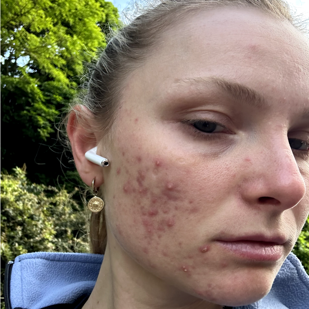 Before image of MADELINE