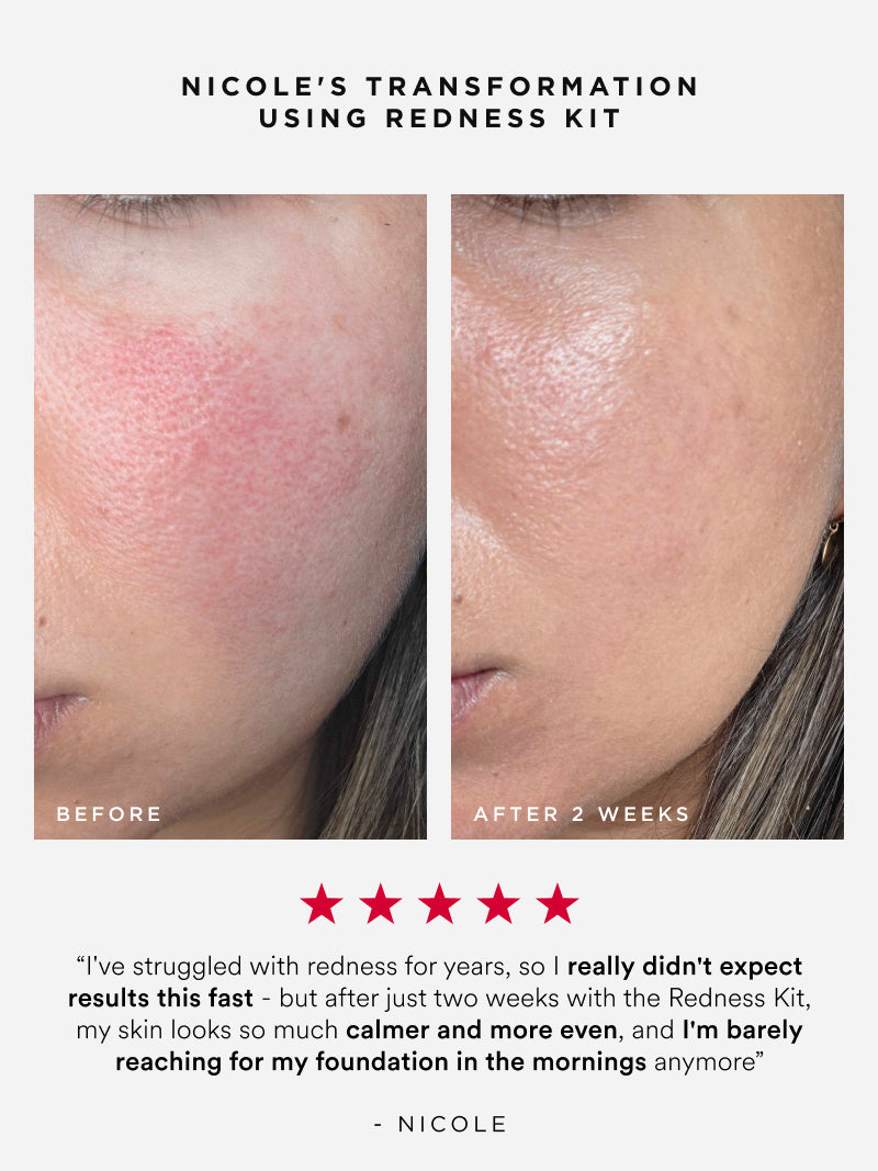 Redness Kit