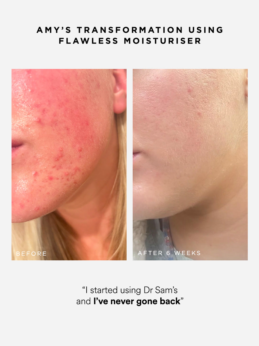 Flawless Moisturiser