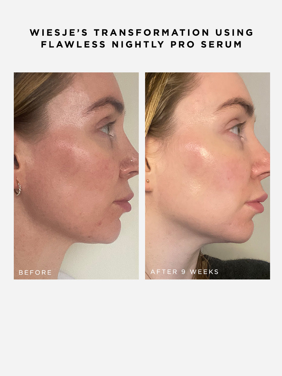 Flawless Nightly Pro 5% Retinoid Serum