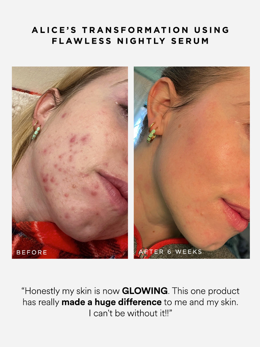 Flawless Nightly 2% Retinoid Serum