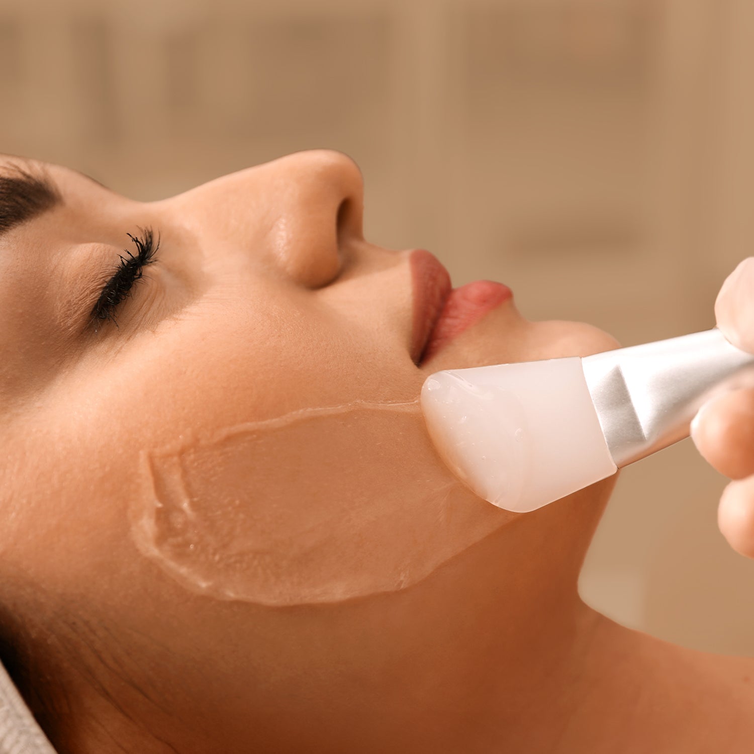Image representing TCA CROSS for Acne Scarring