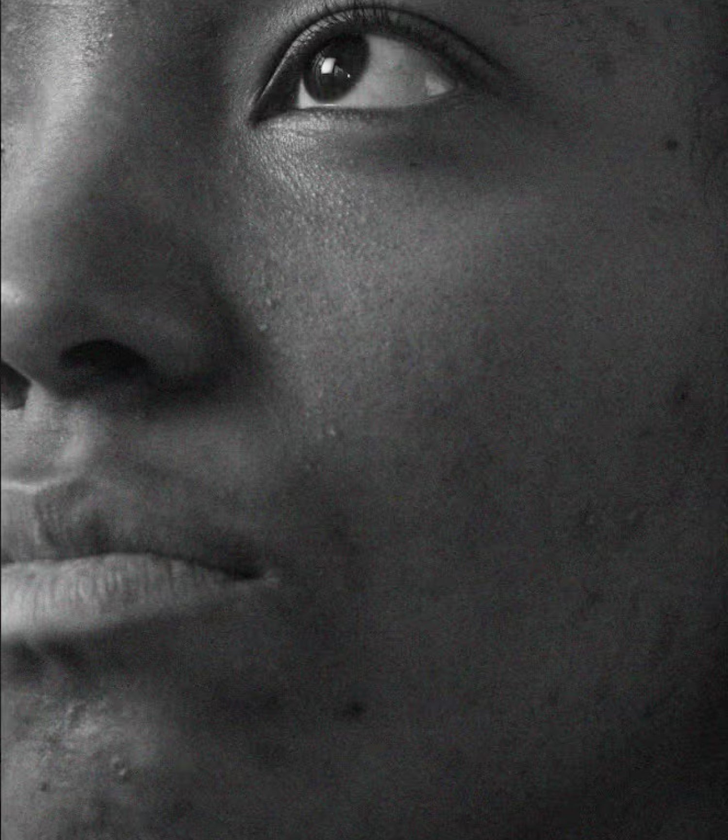 Image representing Blemish Prone