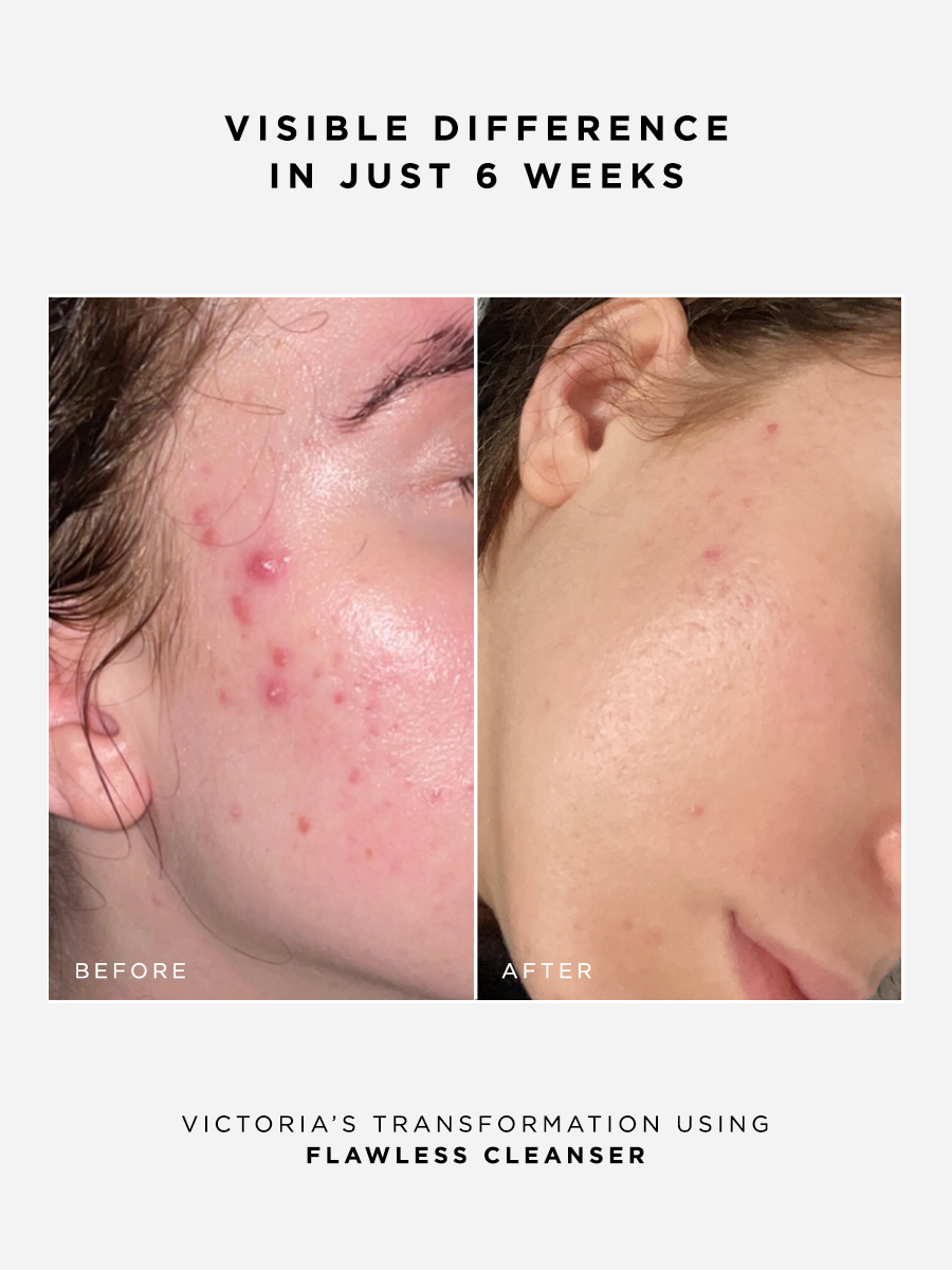 Perfected Basics Holiday Set