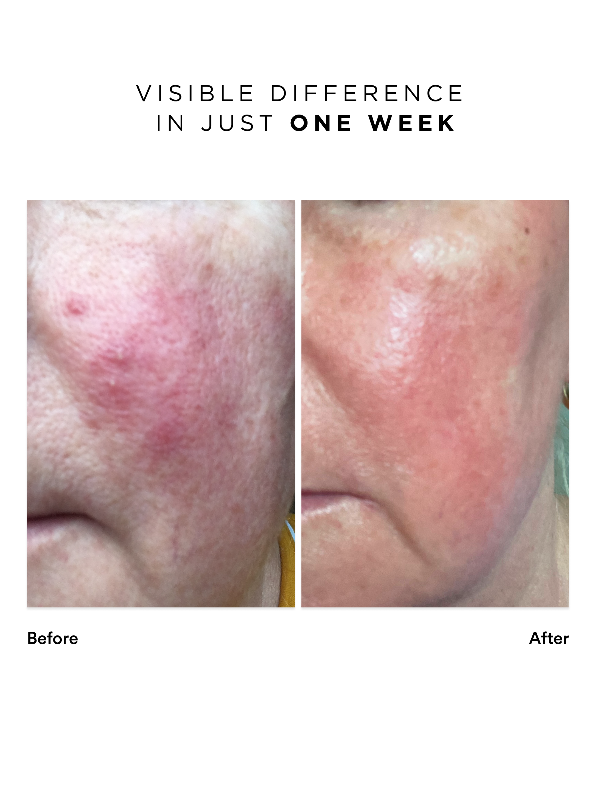 Flawless Moisturiser Intense