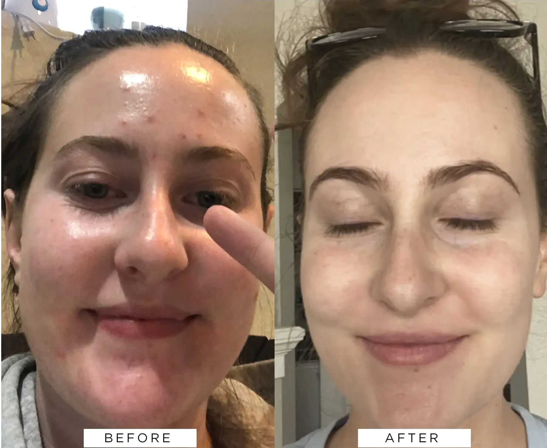 Image representing Award-winning retinoid ✔️