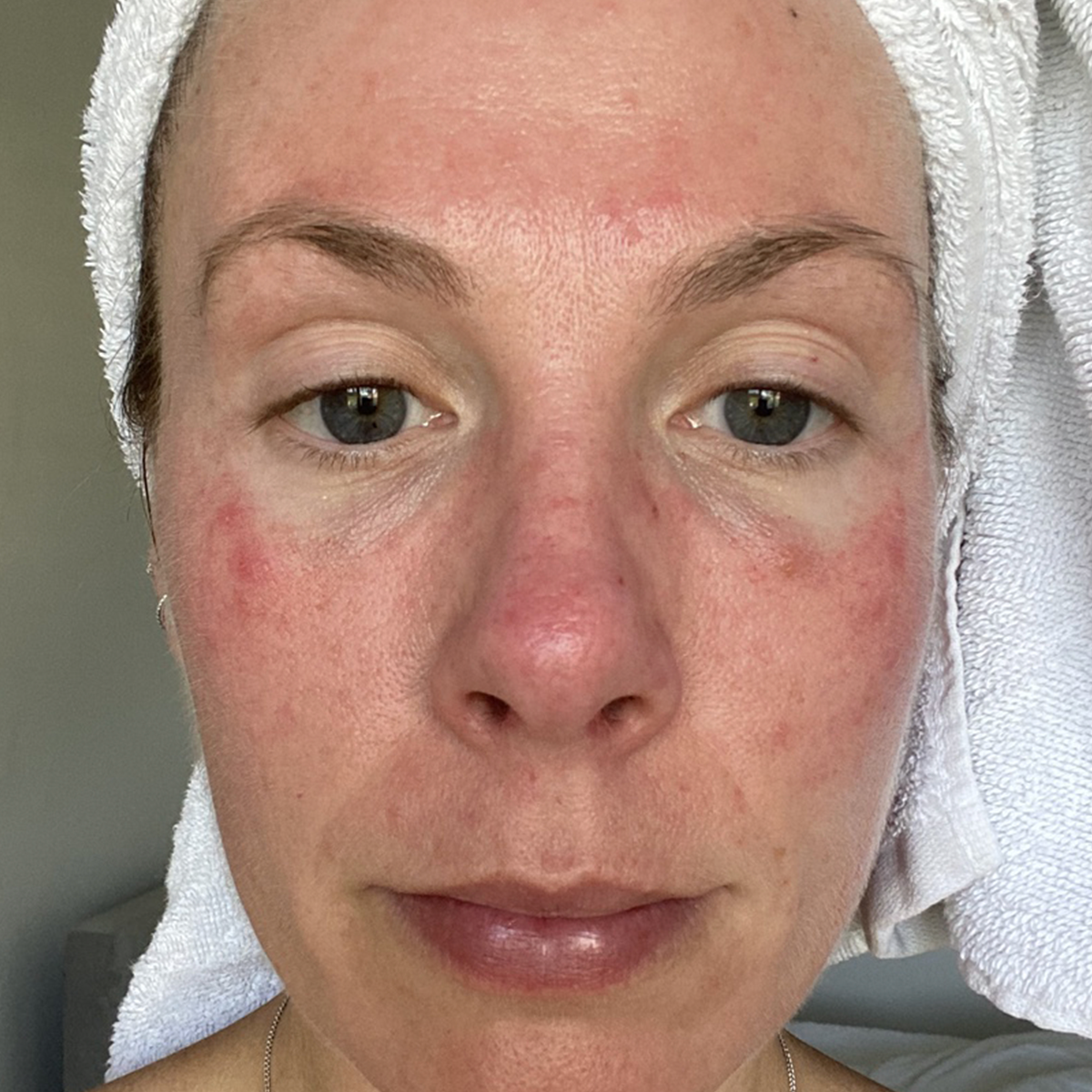 Before image of NATALIE