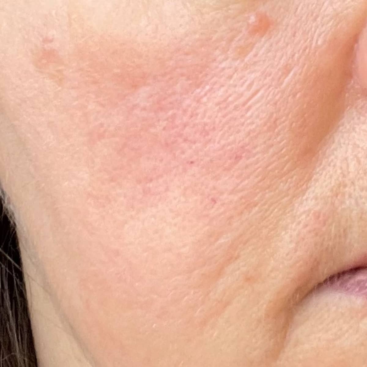 After image of Redness