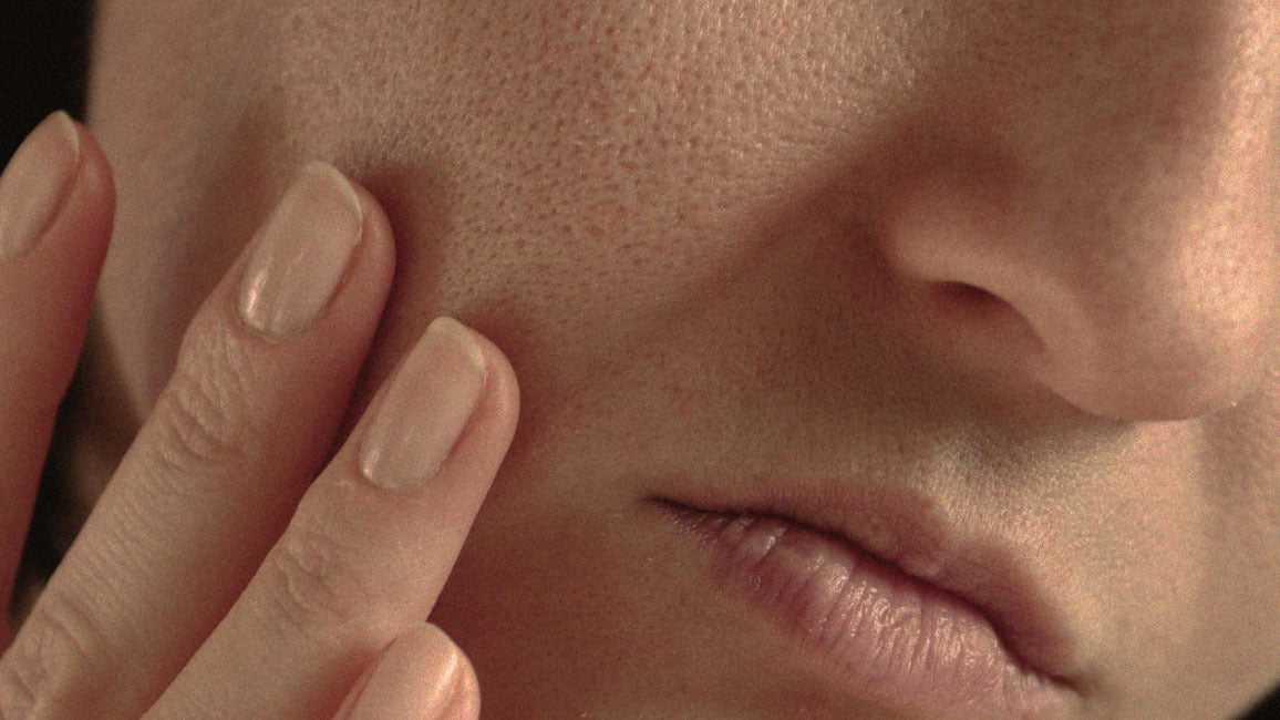 How To Tackle Clogged Pores + Sebaceous Filaments