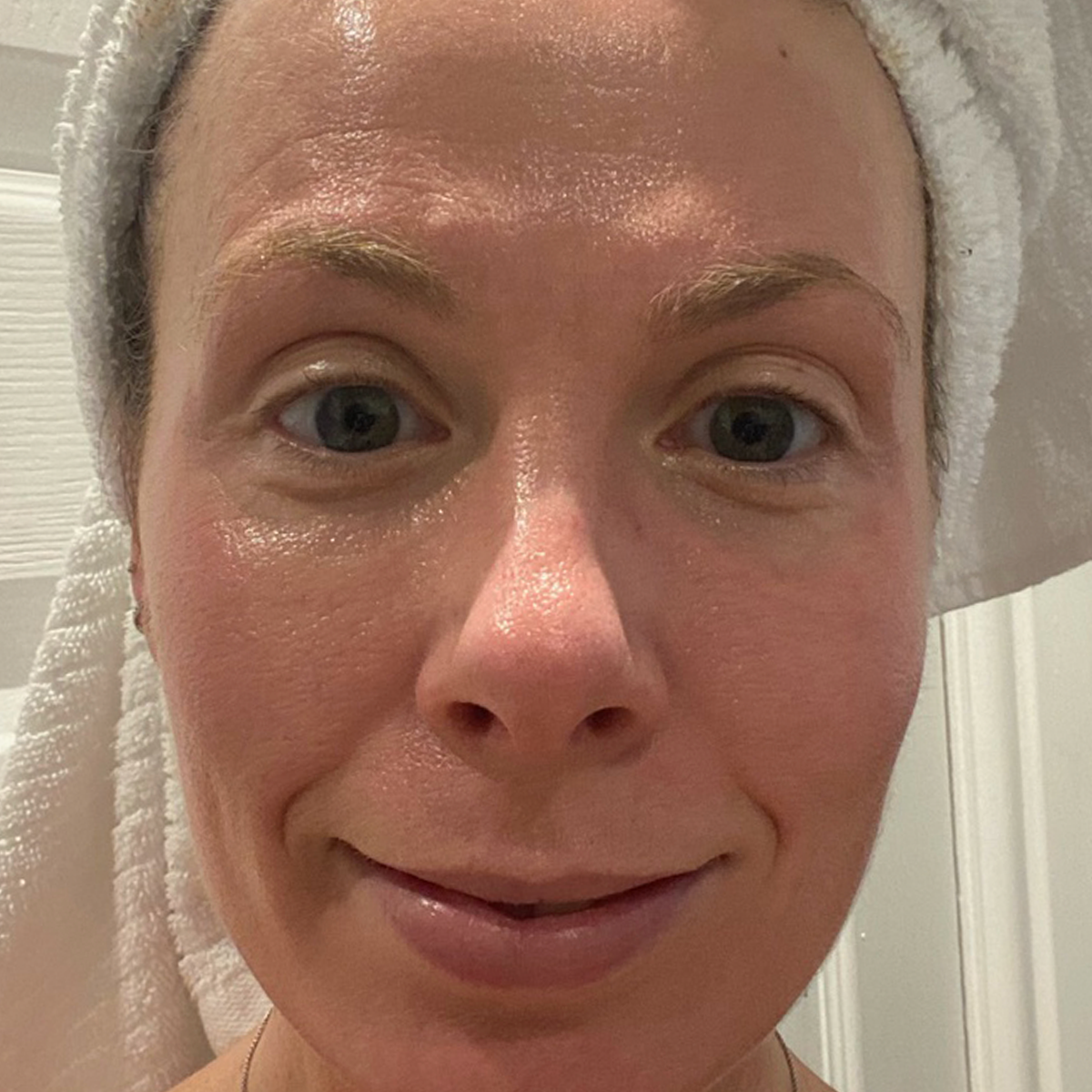 Skincare or a Procedure? How to Know Which One You Actually Need