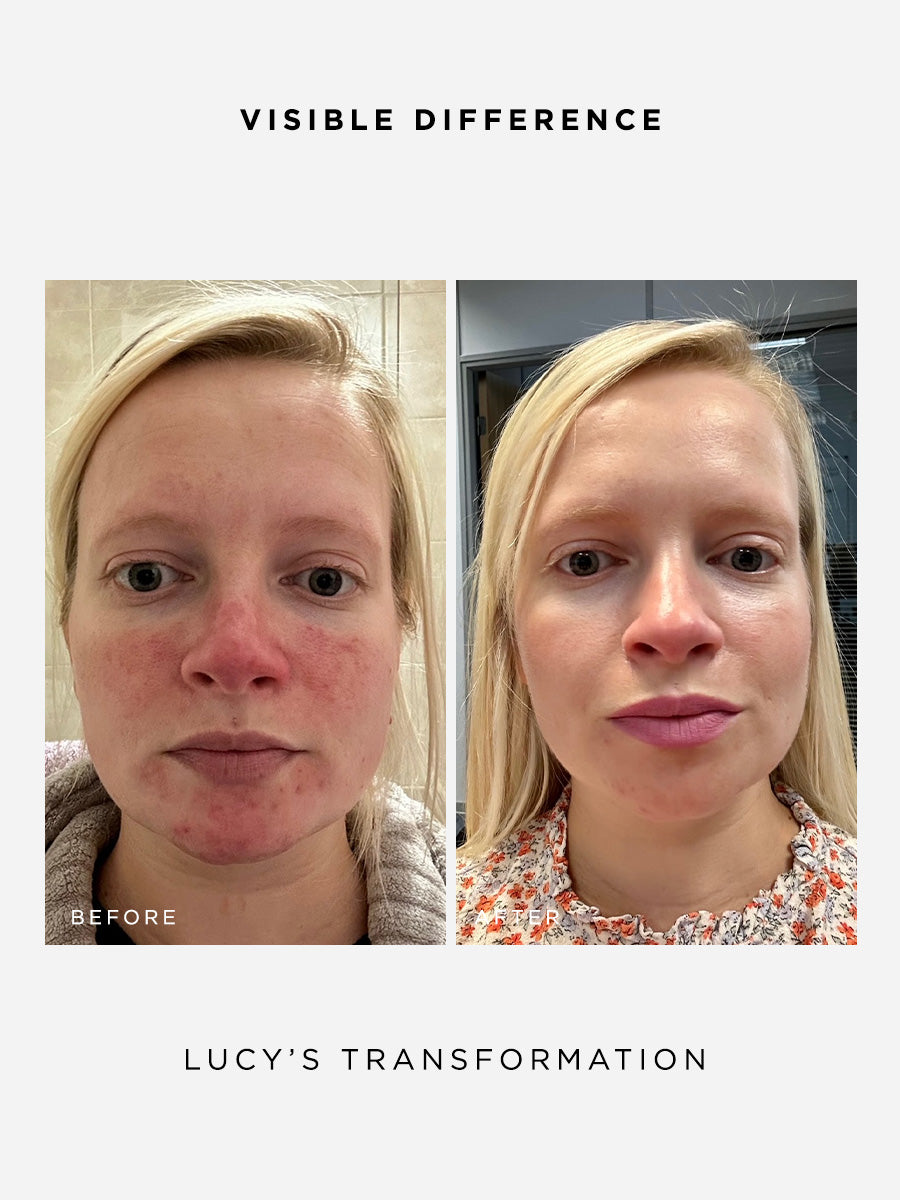 The Radiance Full Size Set | Glow-Boosting Skincare Set | Dr Sam's