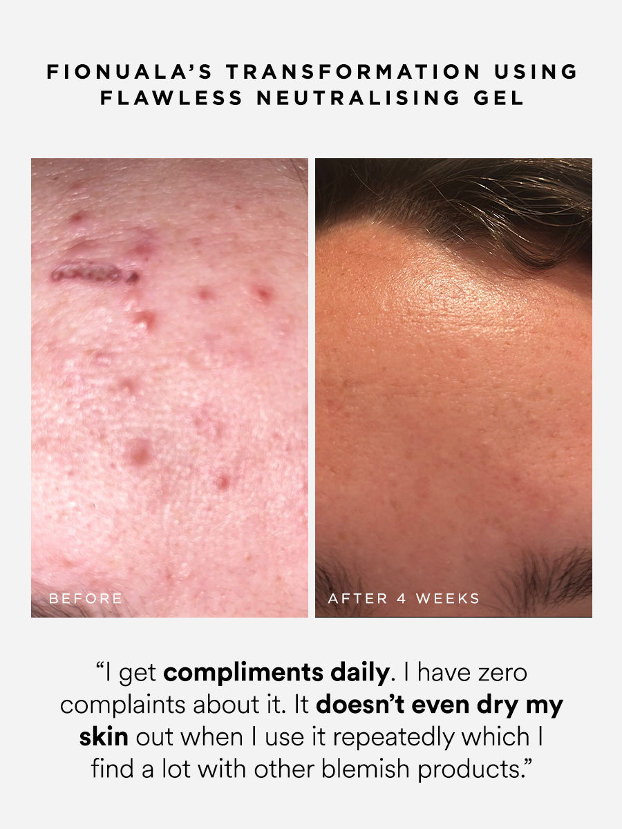 Flawless Neutralising Gel Roller