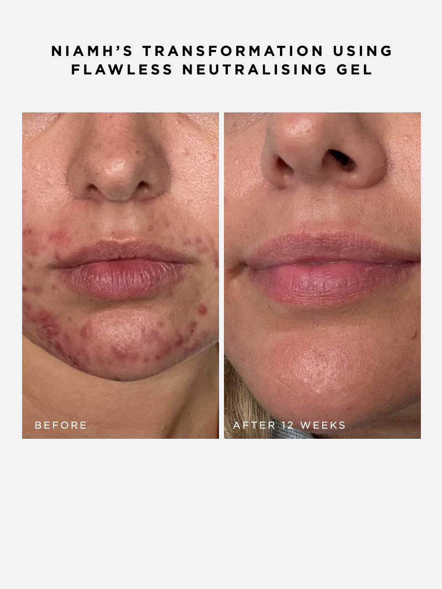 Flawless Neutralising Gel Roller