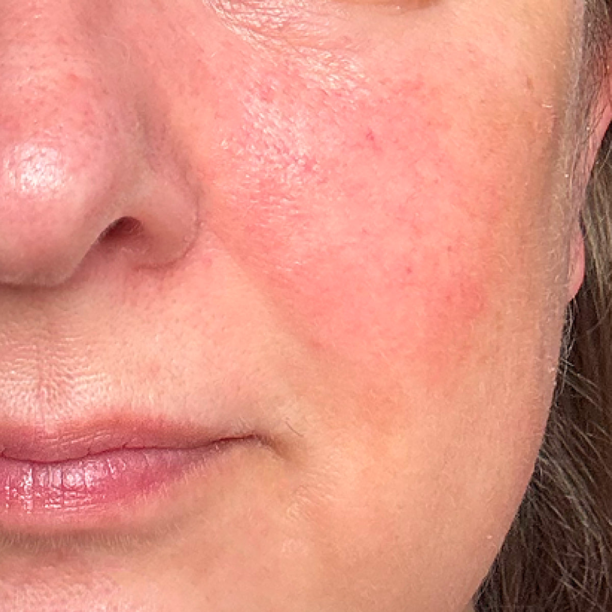 After image of REDNESS