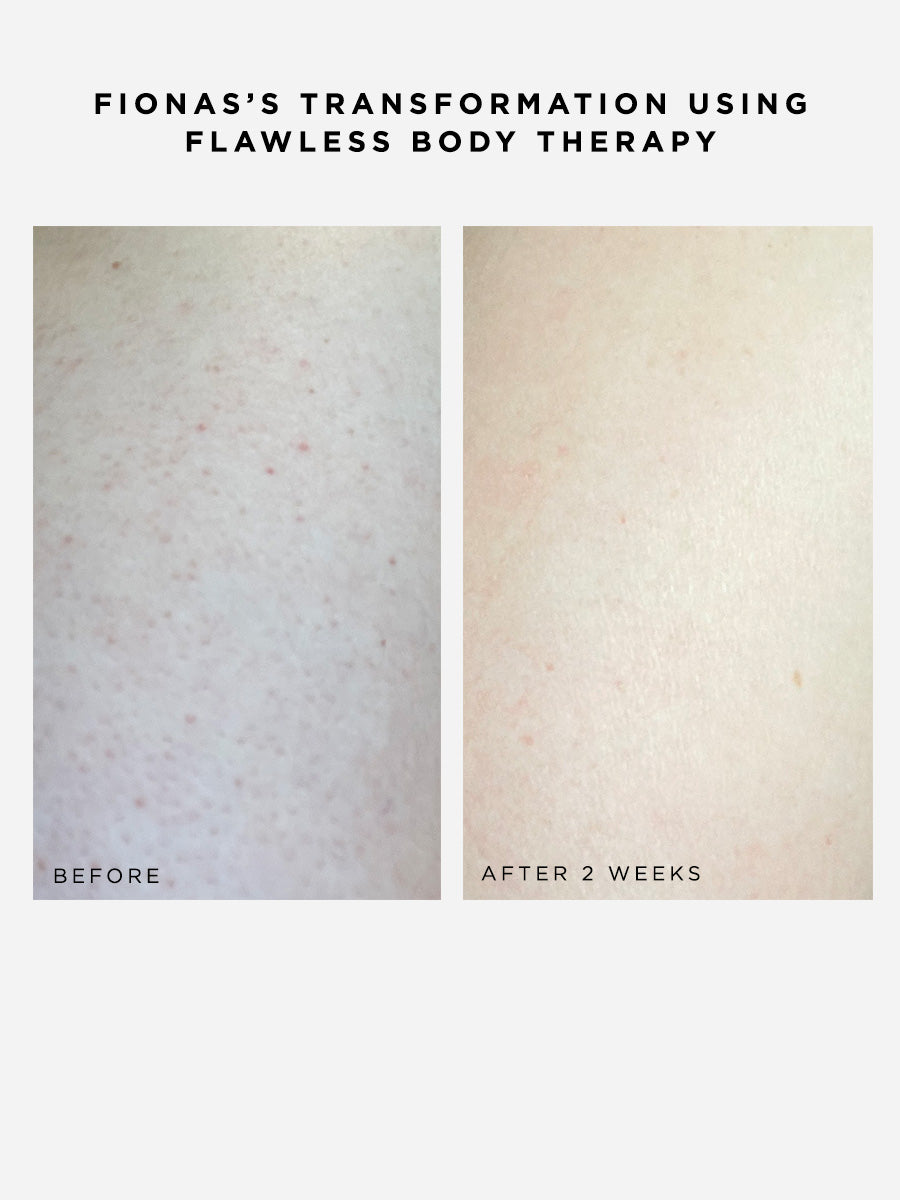 Flawless Body Cleanser