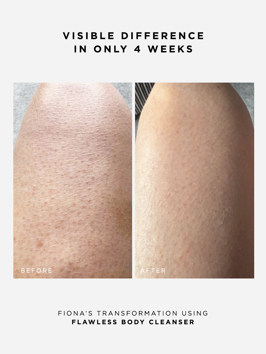 The Body Confidence Set