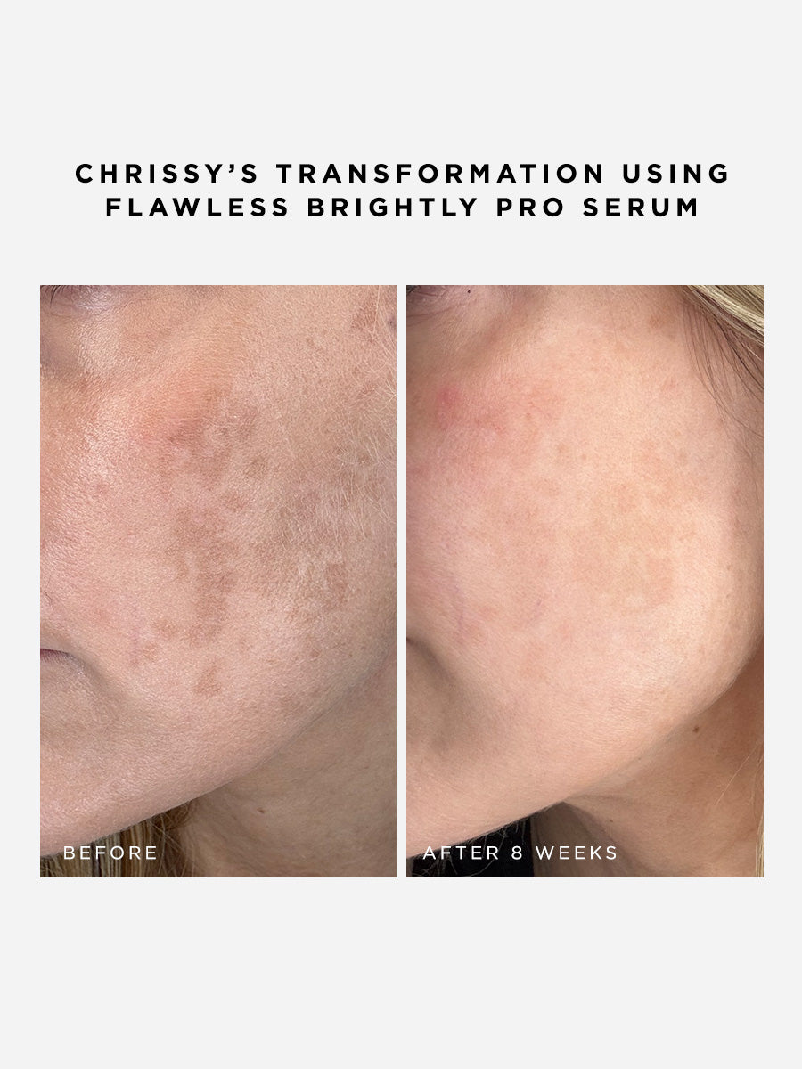 Flawless Brightly Pro Serum