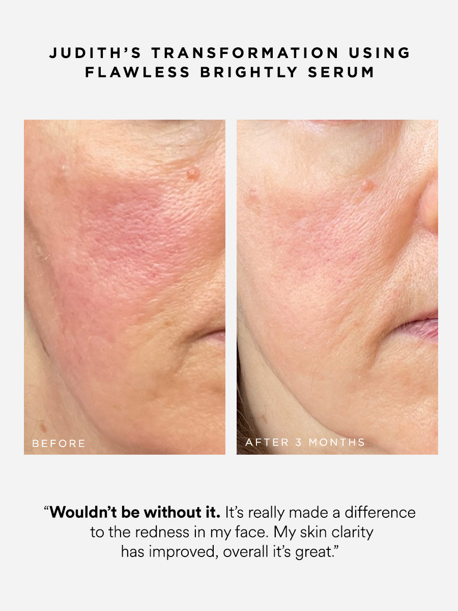 Flawless Brightly 10% Azelaic Acid Serum | Dr Sam's