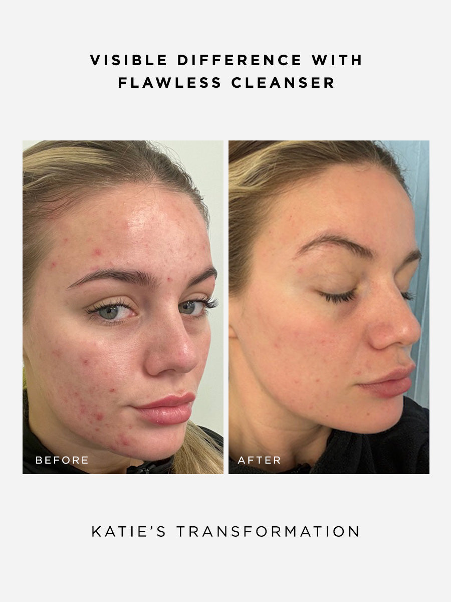 The Clarity Full Size Set