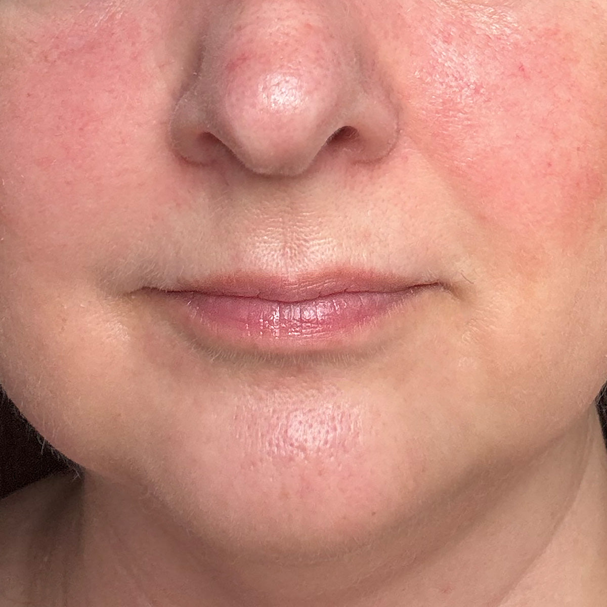 After image of Redness