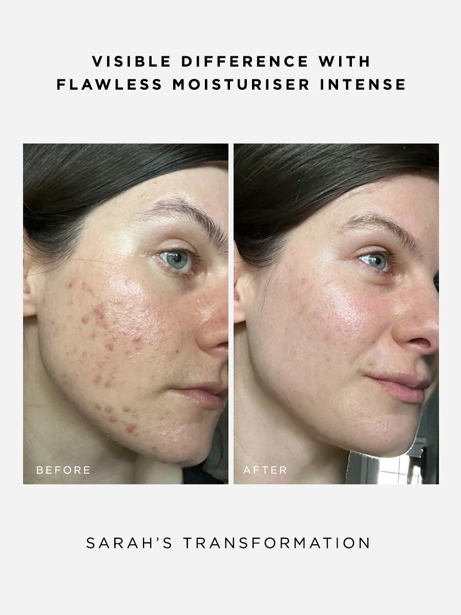 The Clarity Full Size Set