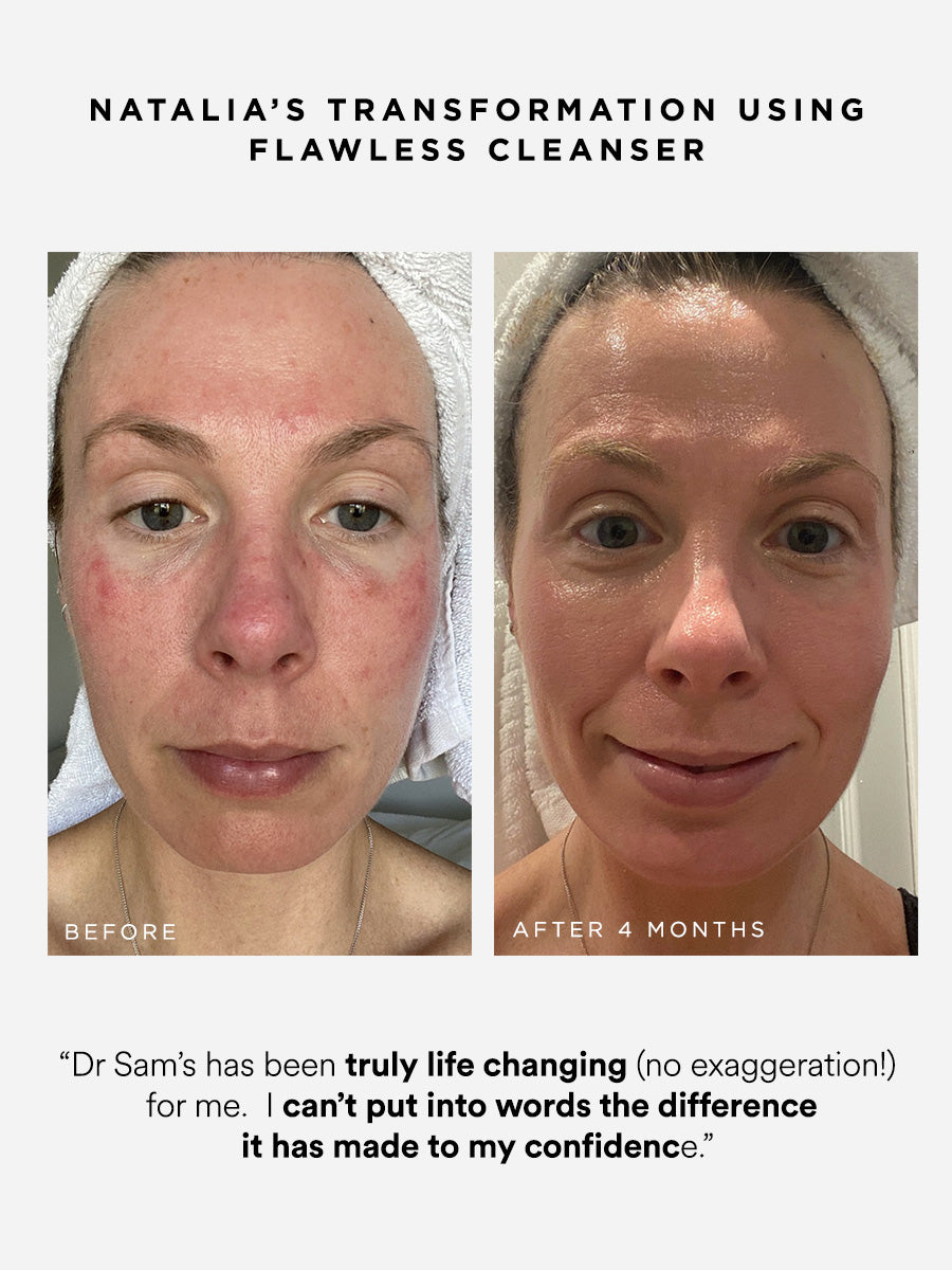 Cheatsheet How To Manage Redness – Dr Sam's