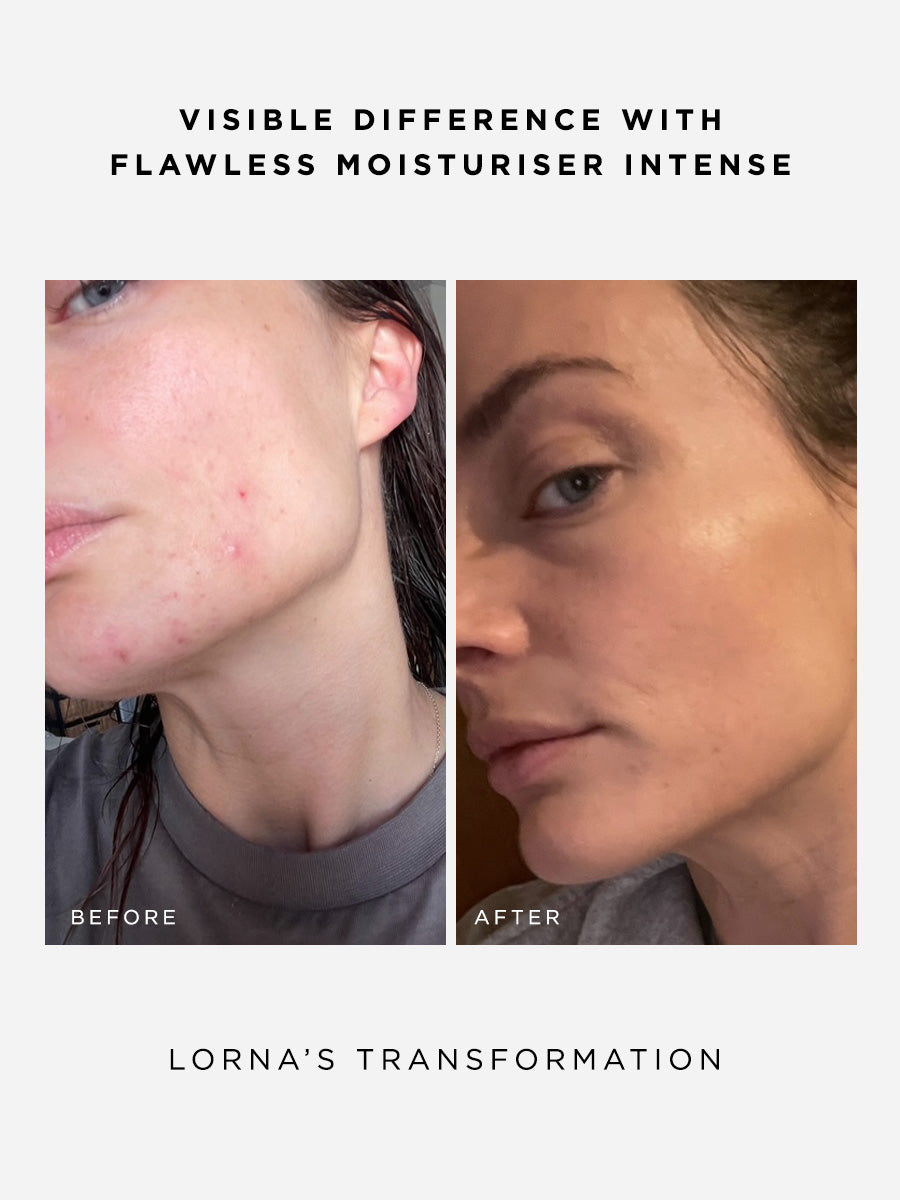 The Radiance Full Size Set