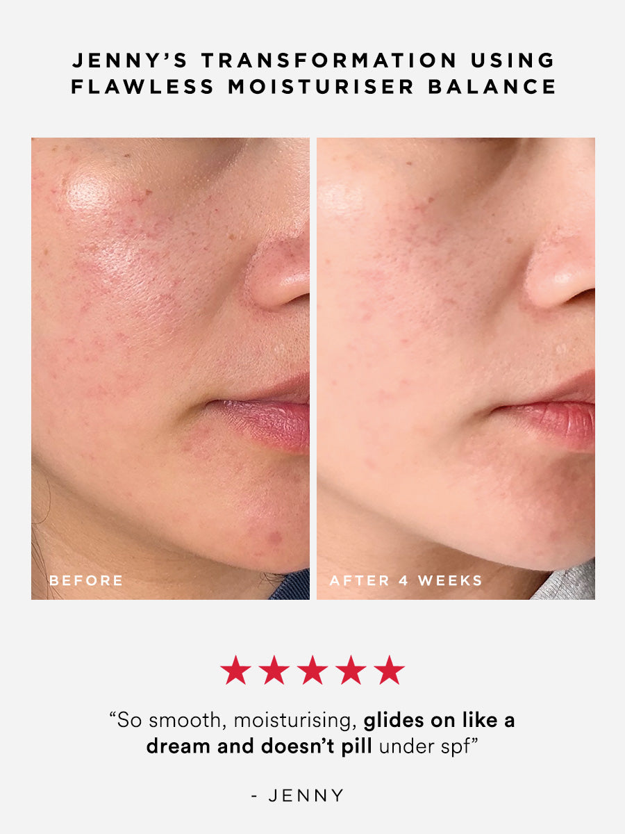 Flawless Moisturiser Balance