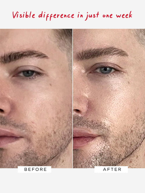 Flawless Moisturiser Intense | NAD+ Boosting Barrier Repair Cream – Dr ...