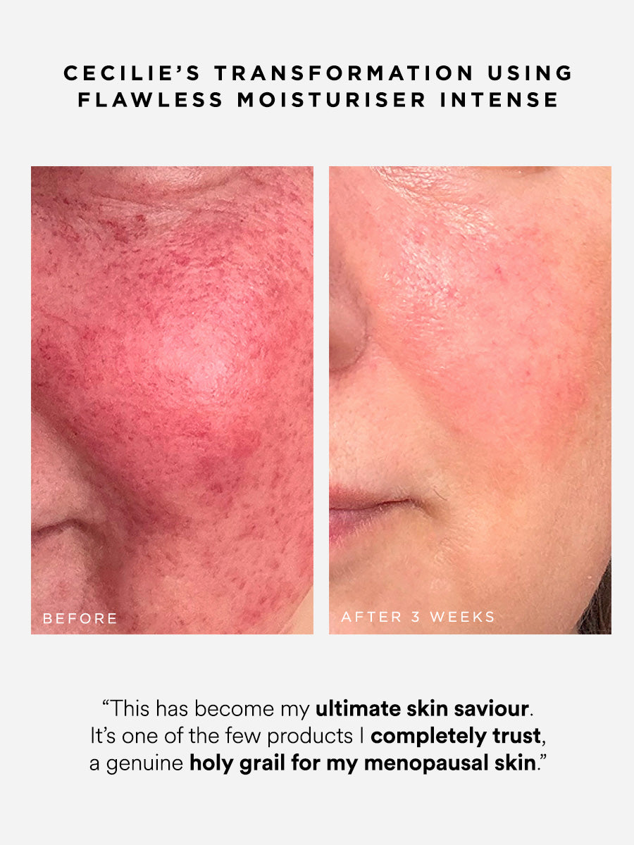 Flawless Moisturiser Intense