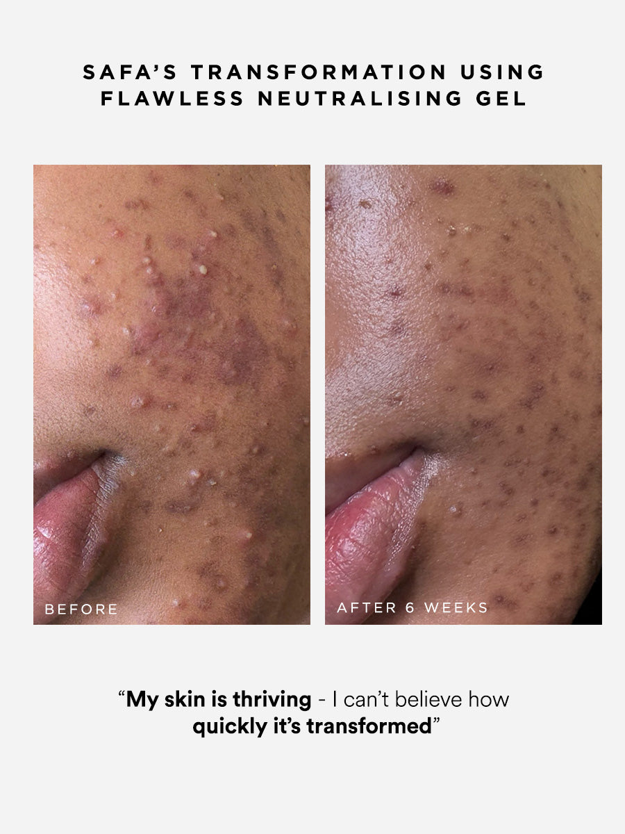 Flawless Neutralising Gel