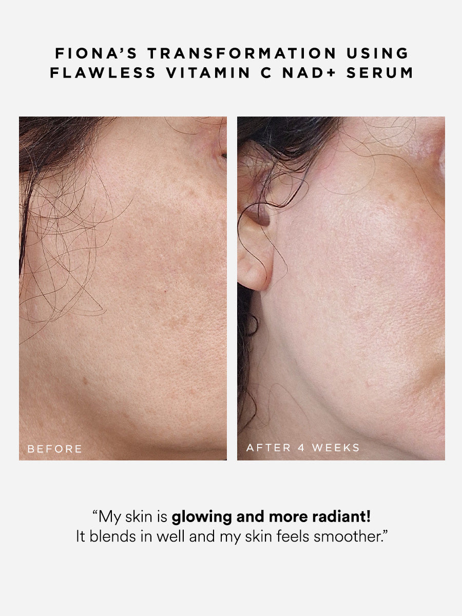 Flawless Vitamin C NAD+ Serum