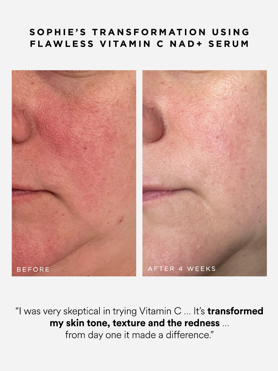 Flawless Vitamin C NAD+ Serum